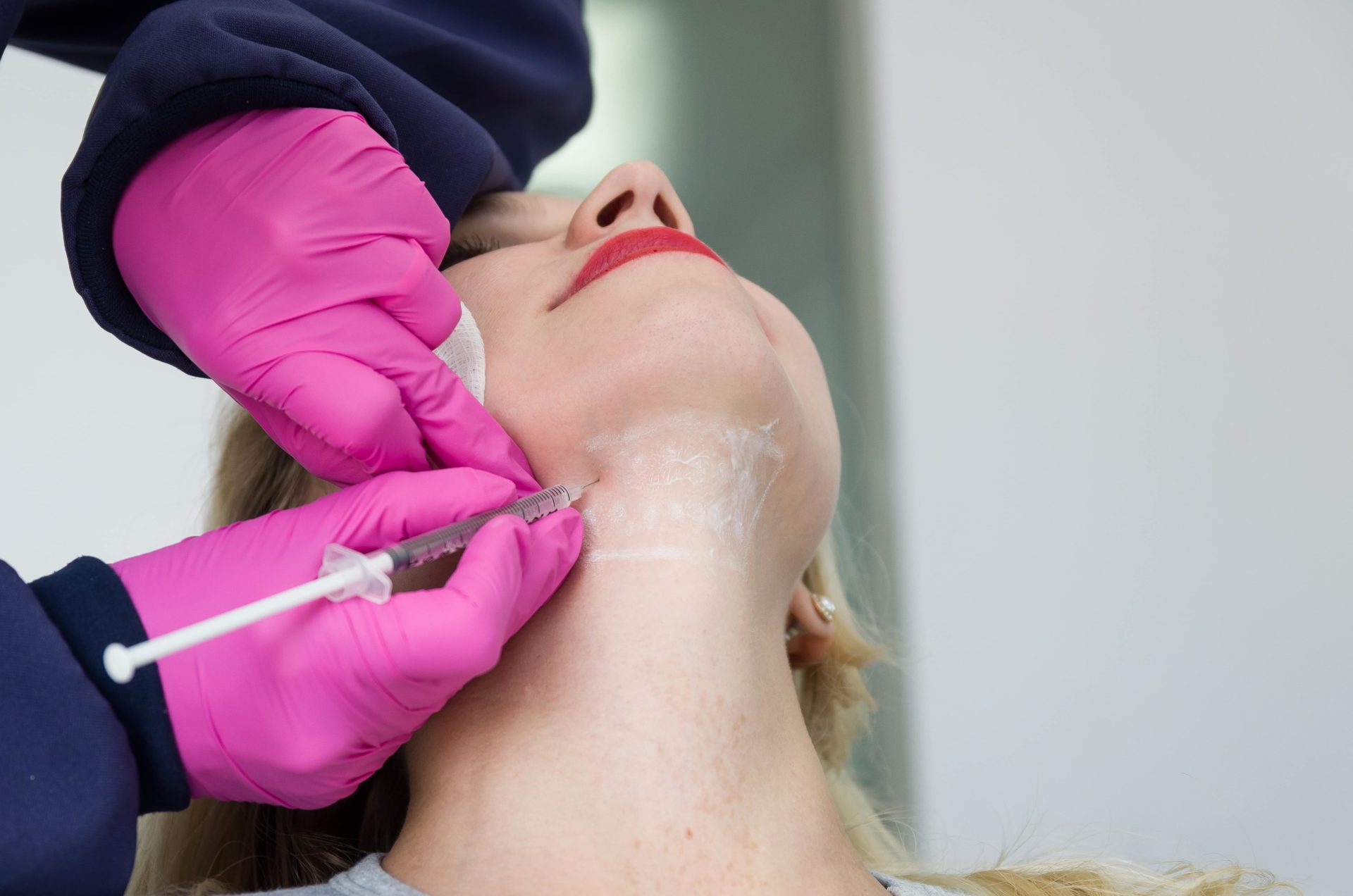 7 Things You Should Know Before A Kybella Treatment